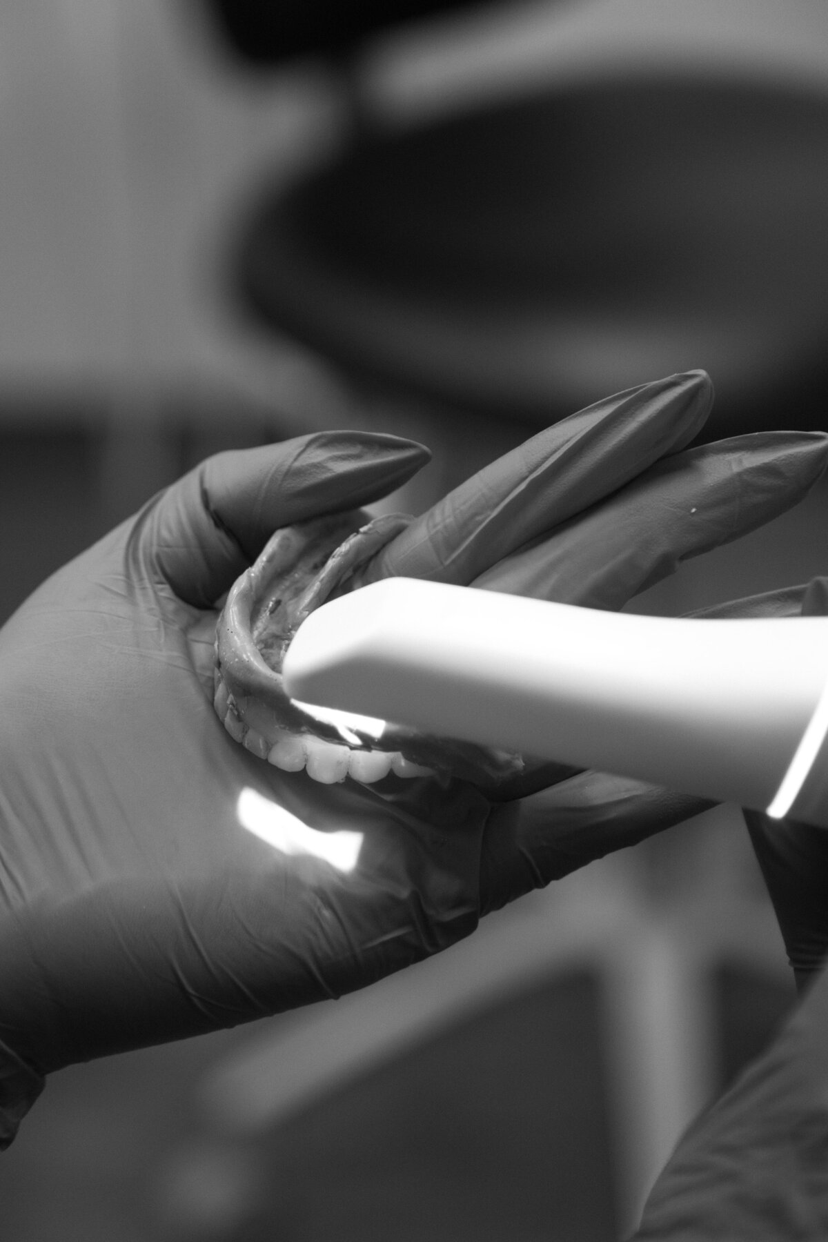 Digital intraoral scanning in progress