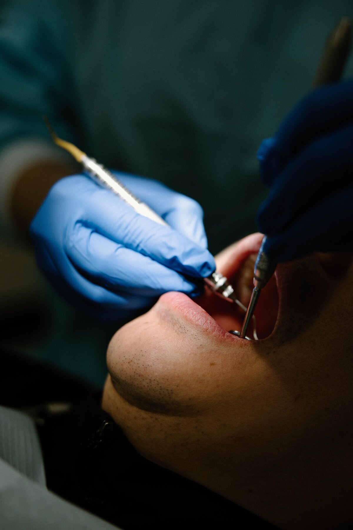 Care in progress at Langdon Smiles Dental